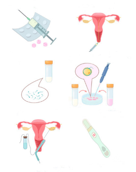 Stages of IVF