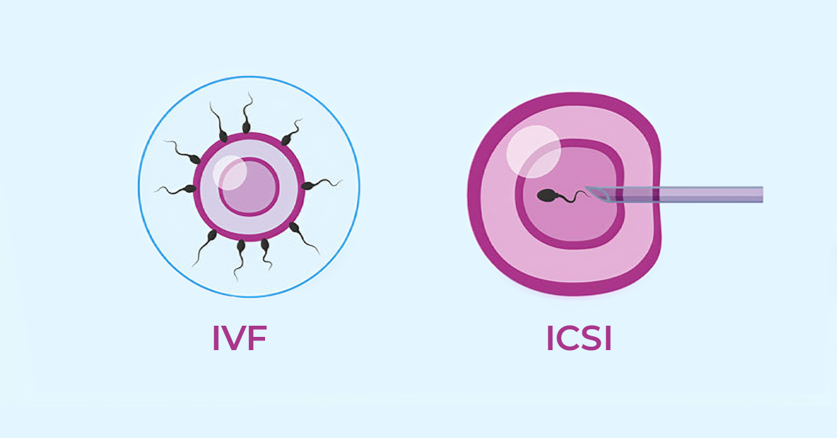 IVF after menopause and pregnancy possibilities